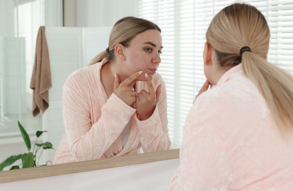 akne-olusumunu-tetikleyen-baslica-faktorler